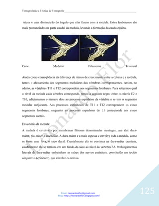 Tomografando a Técnica de Tomografar_______________________________________________________



raízes e uma diminuição do ângulo que elas fazem com a medula. Estes fenômenos são
mais pronunciados na parte caudal da medula, levando a formação da cauda eqüina.




Cone                    Medular                         Filamento                 Terminal


Ainda como conseqüência da diferença de ritmos de crescimento entre a coluna e a medula,
temos o afastamento dos segmentos medulares das vértebras correspondentes. Assim, no
adulto, as vértebras T11 e T12 correspondem aos segmentos lombares. Para sabermos qual
o nível da medula cada vértebra corresponde, temos a seguinte regra: entre os níveis C2 e
T10, adicionamos o número dois ao processo espinhoso da vértebra e se tem o segmento
medular subjacente. Aos processos espinhosos de T11 e T12 correspondem os cinco
segmentos lombares, enquanto ao processo espinhoso de L1 corresponde aos cinco
segmentos sacrais.

Envoltório da medula:

A medula é envolvida por membranas fibrosas denominadas menínges, que são: dura-
máter, pia-máter e aracnóide. A dura-máter e a mais espessa e envolve toda a medula, como
se fosse uma luva, o saco dural. Cranialmente ela se continua na dura-máter craniana,
caudalmente ela se termina em um fundo-de-saco ao nível da vértebra S2. Prolongamentos
laterais da dura-máter embainham as raízes dos nervos espinhais, constituído um tecido
conjuntivo (epineuro), que envolve os nervos.




                               Email: leonardosflor@gmail.com
                            Blog: http://leonardoflor.blogspot.com/
                                                                                              125
 