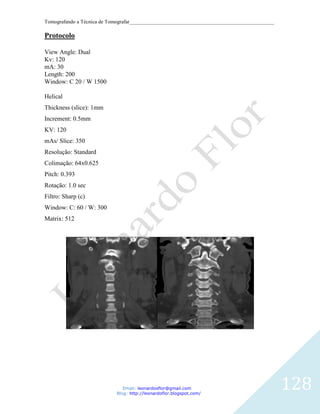 Tomografando a Técnica de Tomografar_______________________________________________________

Protocolo

View Angle: Dual
Kv: 120
mA: 30
Length: 200
Window: C 20 / W 1500

Helical
Thickness (slice): 1mm
Increment: 0.5mm
KV: 120
mAs/ Slice: 350
Resolução: Standard
Colimação: 64x0.625
Pitch: 0.393
Rotação: 1.0 sec
Filtro: Sharp (c)
Window: C: 60 / W: 300
Matrix: 512




                               Email: leonardosflor@gmail.com
                            Blog: http://leonardoflor.blogspot.com/
                                                                                              128
 