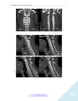 Tomografando a Técnica de Tomografar_______________________________________________________




                               Email: leonardosflor@gmail.com
                            Blog: http://leonardoflor.blogspot.com/
                                                                                              129
 
