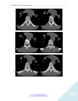 Tomografando a Técnica de Tomografar_______________________________________________________




                               Email: leonardosflor@gmail.com
                            Blog: http://leonardoflor.blogspot.com/
                                                                                              130
 