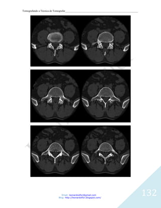 Tomografando a Técnica de Tomografar_______________________________________________________




                               Email: leonardosflor@gmail.com
                            Blog: http://leonardoflor.blogspot.com/
                                                                                              132
 