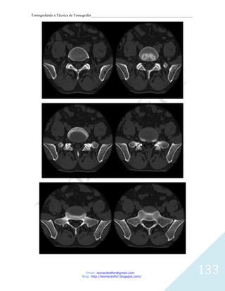 Tomografando a Técnica de Tomografar_______________________________________________________




                               Email: leonardosflor@gmail.com
                            Blog: http://leonardoflor.blogspot.com/
                                                                                              133
 