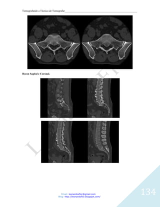Tomografando a Técnica de Tomografar_______________________________________________________




Recon Sagital e Coronal.




                               Email: leonardosflor@gmail.com
                            Blog: http://leonardoflor.blogspot.com/
                                                                                              134
 