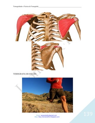 Tomografando a Técnica de Tomografar_______________________________________________________




TOMOGRAFIA DO JOELHO




                               Email: leonardosflor@gmail.com
                            Blog: http://leonardoflor.blogspot.com/
                                                                                              139
 