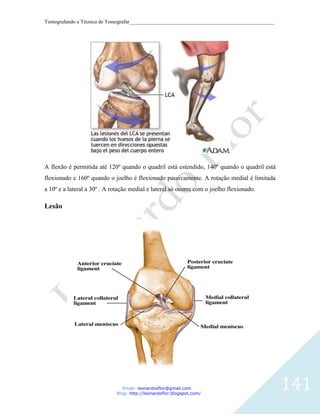 Tomografando a Técnica de Tomografar_______________________________________________________




A flexão é permitida até 120º quando o quadril está estendido, 140º quando o quadril está
flexionado e 160º quando o joelho é flexionado passivamente. A rotação medial é limitada
a 10º e a lateral a 30º . A rotação medial e lateral só ocorre com o joelho flexionado.

Lesão




                                Email: leonardosflor@gmail.com
                             Blog: http://leonardoflor.blogspot.com/
                                                                                              141
 