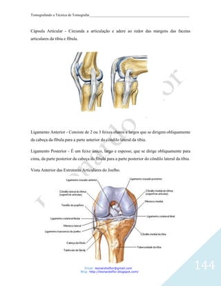 Tomografando a Técnica de Tomografar_______________________________________________________



Cápsula Articular - Circunda a articulação e adere ao redor das margens das facetas
articulares da tíbia e fíbula.




Ligamento Anterior - Consiste de 2 ou 3 feixes chatos e largos que se dirigem obliquamente
da cabeça da fíbula para a parte anterior do côndilo lateral da tíbia.

Ligamento Posterior - É um feixe único, largo e espesso, que se dirige obliquamente para
cima, da parte posterior da cabeça da fíbula para a parte posterior do côndilo lateral da tíbia.

Vista Anterior das Estruturas Articulares do Joelho.




                                    Email: leonardosflor@gmail.com
                                 Blog: http://leonardoflor.blogspot.com/
                                                                                                   144
 