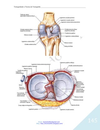 Tomografando a Técnica de Tomografar_______________________________________________________




                               Email: leonardosflor@gmail.com
                            Blog: http://leonardoflor.blogspot.com/
                                                                                              145
 