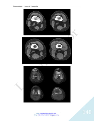 Tomografando a Técnica de Tomografar_______________________________________________________




                               Email: leonardosflor@gmail.com
                            Blog: http://leonardoflor.blogspot.com/
                                                                                              148
 