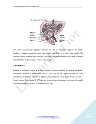 Tomografando a Técnica de Tomografar_______________________________________________________




Por outro lado, tumores hepáticos derivam 85% de sua irrigação sanguinea da artéria
hepática e podem apresentar uma contrastação significativa, já nessa fase inicial. Na
verdade, alguns tumores especialmente vascularizados podem aparecer realçados de forma
mais brilhante do que o fígado normal nesse estagio.


Fase venosa

Quando o contraste atinge a artéria hepática, chegam também às artérias esplênica,
mesentérica superior e mesentérica inferior. Cerca de 10 seg. depois retorna via veias
esplênicas, mesentérica superior e inferior, para preencher a veia porta. Uma vez que o
fígado normal deriva cerca de 85% de sua irrigação sanguínea dessa veia, uma acentuada
contrastação hepática normal é observada nessa fase.




                               Email: leonardosflor@gmail.com
                            Blog: http://leonardoflor.blogspot.com/
                                                                                              22
 