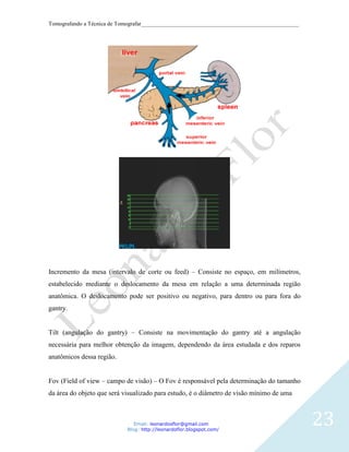 Tomografando a Técnica de Tomografar_______________________________________________________




Incremento da mesa (intervalo de corte ou feed) – Consiste no espaço, em milímetros,
estabelecido mediante o deslocamento da mesa em relação a uma determinada região
anatômica. O deslocamento pode ser positivo ou negativo, para dentro ou para fora do
gantry.


Tilt (angulação do gantry) – Consiste na movimentação do gantry até a angulação
necessária para melhor obtenção da imagem, dependendo da área estudada e dos reparos
anatômicos dessa região.


Fov (Field of view – campo de visão) – O Fov é responsável pela determinação do tamanho
da área do objeto que será visualizado para estudo, é o diâmetro de visão mínimo de uma



                               Email: leonardosflor@gmail.com
                            Blog: http://leonardoflor.blogspot.com/
                                                                                              23
 