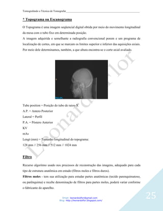 Tomografando a Técnica de Tomografar_______________________________________________________


* Topograma ou Escanograma

O Topograma é uma imagem seqüencial digital obtida por meio do movimento longitudinal
da mesa com o tubo fixo em determinada posição.
A imagem adquirida e semelhante a radiografia convencional porem e um programa de
localização de cortes, em que se marcam os limites superior e inferior das aquisições axiais.
Por meio dele determinamos, também, a que altura encontra-se o corte axial avaliado.




Tube position = Posição do tubo de raios-X
A.P. = Antero Posterior
Lateral = Perfil
P.A. = Póstero Anterior
KV
mAs
Lengt (mm) = Tamanho longitudinal do topograma:
128 mm // 256 mm // 512 mm // 1024 mm


Filtro

Recurso algoritmo usado nos processos de reconstrução das imagens, adequado para cada
tipo de estrutura anatômica em estudo (filtros moles e filtros duros).
Filtros moles - tem sua utilização para estudar partes anatômicas (tecido parenquimatoso,
ou parênquima) e recebe denominação de filtros para partes moles, poderá variar conforme
o fabricante do aparelho.


                                Email: leonardosflor@gmail.com
                             Blog: http://leonardoflor.blogspot.com/
                                                                                                25
 