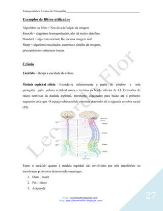 Tomografando a Técnica de Tomografar_______________________________________________________


Exemplos de filtros utilizados

Algorithm ou filtro = Nos dá a definição da imagem
Smooth = algaritmo homogenizador, não dá muitos detalhes
Standard = algaritmo normal, lhe dá uma imagem real
Sharp = algaritmo ressaltador, aumenta o detalhe da imagem,
principalmente estruturas ósseas.



Crânio

Encéfalo – Ocupa a cavidade do crânio.


Medula espinhal sólida - Estende-se inferiormente a partir do cérebro              e   está
protegida   pela coluna vertebral óssea e termina na borda inferior de L1. Extensões de
raízes nervosas da medula espinhal, entretanto, continuam para baixo até o primeiro
segmento coccígeo. O espaço subaracnóide continua descendo até a segunda vértebra sacral
(S2).




Tanto o encéfalo quanto à medula espinhal são envolvidos por três envoltórios ou
membranas protetoras denominadas meninges.
   1. Dura – máter
   2. Pia – máter
   3. Aracnóide

                               Email: leonardosflor@gmail.com
                            Blog: http://leonardoflor.blogspot.com/
                                                                                              27
 