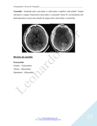 Tomografando a Técnica de Tomografar_______________________________________________________


Aracnóide - localizada entre a pia-máter e a dura-máter e significa “mãe aranha”. Espaço
sub-dural é o espaço virtual entre a dura-máter e a aracnóide. Numa TC, um hematoma sub-
dural apresenta-se como uma coleção de sangue entre a dura-máter e a aracnóide.




Divisões do encéfalo

Prosencéfalo
Cérebro – (Telencéfalo)
Tálamo – (Diencéfalo)
Hipotálamo – (Diencéfalo)




                               Email: leonardosflor@gmail.com
                            Blog: http://leonardoflor.blogspot.com/
                                                                                              29
 