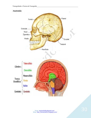 Tomografando a Técnica de Tomografar_______________________________________________________


Anatomia




                               Email: leonardosflor@gmail.com
                            Blog: http://leonardoflor.blogspot.com/
                                                                                              30
 