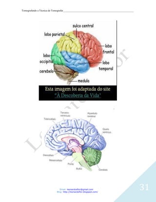 Tomografando a Técnica de Tomografar_______________________________________________________




                               Email: leonardosflor@gmail.com
                            Blog: http://leonardoflor.blogspot.com/
                                                                                              31
 