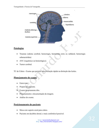 Tomografando a Técnica de Tomografar_______________________________________________________




Patologias

       Traumas (edema cerebral, hemorragia, hematoma extra ou subdural, hemorragia
       subaracnóidea)
       AVC (isquêmico ou hemorrágico).
       Tumor cerebral.


TC de Crânio - Exame que permite uma avaliação rápida na distinção das lesões.


Planejamento do exame

       Entrevista.
       Preparo do paciente.
       Exame propriamente dito.
       Processamento e documentação da imagem.
       Análise do exame.


Posicionamento do paciente

       Mesa com suporte axial para crânio.
       Paciente em decúbito dorsal, o mais confortável possível.


                                 Email: leonardosflor@gmail.com
                              Blog: http://leonardoflor.blogspot.com/
                                                                                              32
 