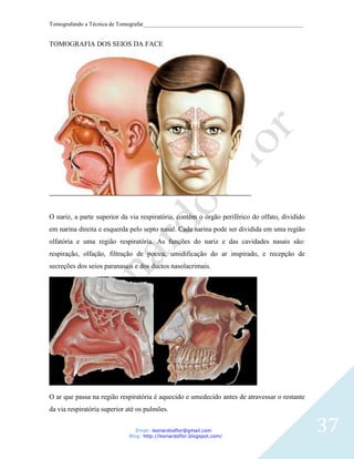 Tomografando a Técnica de Tomografar_______________________________________________________


TOMOGRAFIA DOS SEIOS DA FACE




O nariz, a parte superior da via respiratória, contém o órgão periférico do olfato, dividido
em narina direita e esquerda pelo septo nasal. Cada narina pode ser dividida em uma região
olfatória e uma região respiratória. As funções do nariz e das cavidades nasais são:
respiração, olfação, filtração de poeira, umidificação do ar inspirado, e recepção de
secreções dos seios paranasais e dos ductos nasolacrimais.




O ar que passa na região respiratória é aquecido e umedecido antes de atravessar o restante
da via respiratória superior até os pulmões.


                                Email: leonardosflor@gmail.com
                             Blog: http://leonardoflor.blogspot.com/
                                                                                               37
 