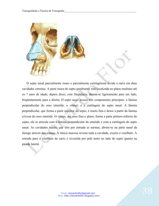 Tomografando a Técnica de Tomografar_______________________________________________________




   O septo nasal parcialmente ósseo e parcialmente cartilaginoso divide o nariz em duas
cavidades estreitas. A parte óssea do septo geralmente está localizada no plano mediano até
os 7 anos de idade; depois disso, com freqüência, desvia-se ligeiramente para um lado,
freqüentemente para a direita. O septo nasal possui três componentes principais: a lâmina
perpendicular do osso etmóide; o vômer; e a cartilagem do septo nasal. A lâmina
perpendicular, que forma a parte superior do septo, é muito fina e desce a partir da lâmina
crivosa do osso etmóide. O vômer, um osso fino e plano, forma a parte póstero-inferior do
septo; ele se articula com a lâmina perpendicular do etmóide e com a cartilagem do septo
nasal. As cavidades nasais, que têm por entrada as narinas, abrem-se na parte nasal da
faringe através das coanas. A túnica mucosa reveste toda a cavidade, exceto o vestíbulo. A
entrada para o vestíbulo do nariz é revestida por pele tanto no lado do septo quanto na
parede lateral.




                               Email: leonardosflor@gmail.com
                            Blog: http://leonardoflor.blogspot.com/
                                                                                              38
 