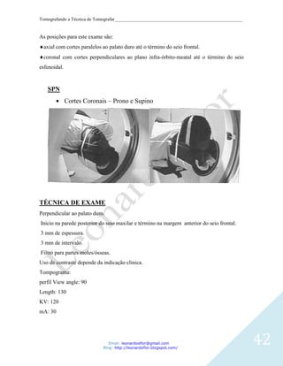 Tomografando a Técnica de Tomografar_______________________________________________________


As posições para este exame são:
 axial com cortes paralelos ao palato duro até o término do seio frontal.
 coronal com cortes perpendiculares ao plano infra-órbito-meatal até o término do seio
esfenoidal.



   SPN
              Cortes Coronais – Prono e Supino




TÉCNICA DE EXAME
Perpendicular ao palato duro.
Início na parede posterior do seio maxilar e término na margem anterior do seio frontal.
3 mm de espessura.
3 mm de intervalo.
Filtro para partes moles/ósseas.
Uso de contraste depende da indicação clínica.
Tompograma:
perfil View angle: 90
Length: 130
KV: 120
mA: 30




                               Email: leonardosflor@gmail.com
                            Blog: http://leonardoflor.blogspot.com/
                                                                                              42
 