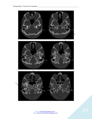 Tomografando a Técnica de Tomografar_______________________________________________________




                               Email: leonardosflor@gmail.com
                            Blog: http://leonardoflor.blogspot.com/
                                                                                              49
 