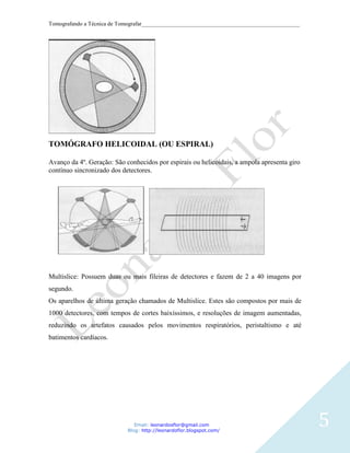 Tomografando a Técnica de Tomografar_______________________________________________________




TOMÓGRAFO HELICOIDAL (OU ESPIRAL)

Avanço da 4º. Geração: São conhecidos por espirais ou helicoidais, a ampola apresenta giro
contínuo sincronizado dos detectores.




Multislice: Possuem duas ou mais fileiras de detectores e fazem de 2 a 40 imagens por
segundo.
Os aparelhos de última geração chamados de Multislice. Estes são compostos por mais de
1000 detectores, com tempos de cortes baixíssimos, e resoluções de imagem aumentadas,
reduzindo os artefatos causados pelos movimentos respiratórios, peristaltismo e até
batimentos cardíacos.




                               Email: leonardosflor@gmail.com
                            Blog: http://leonardoflor.blogspot.com/
                                                                                              5
 