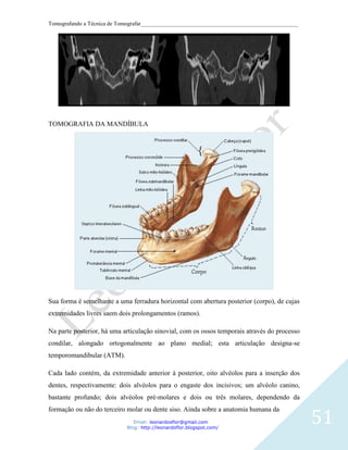 Tomografando a Técnica de Tomografar_______________________________________________________




TOMOGRAFIA DA MANDÍBULA




Sua forma é semelhante a uma ferradura horizontal com abertura posterior (corpo), de cujas
extremidades livres saem dois prolongamentos (ramos).

Na parte posterior, há uma articulação sinovial, com os ossos temporais através do processo
condilar, alongado ortogonalmente ao plano medial; esta articulação designa-se
temporomandibular (ATM).

Cada lado contém, da extremidade anterior à posterior, oito alvéolos para a inserção dos
dentes, respectivamente: dois alvéolos para o engaste dos incisivos; um alvéolo canino,
bastante profundo; dois alvéolos pré-molares e dois ou três molares, dependendo da


                                                                                              51
formação ou não do terceiro molar ou dente siso. Ainda sobre a anatomia humana da
                               Email: leonardosflor@gmail.com
                            Blog: http://leonardoflor.blogspot.com/
 