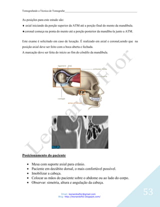 Tomografando a Técnica de Tomografar_______________________________________________________


As posições para este estudo são:
  axial iniciando da porção superior da ATM até a porção final do mento da mandíbula.
 coronal começa na ponta do mento até a porção posterior da mandíbu-la junto a ATM.


Este exame é solicitado em caso de luxação. É realizado em axial e coronal,sendo que na
posição axial deve ser feito com a boca aberta e fechada.
A marcação deve ser feita do início ao fim do côndilo da mandíbula.




Posicionamento do paciente

       Mesa com suporte axial para crânio.
       Paciente em decúbito dorsal, o mais confortável possível.
       Imobilizar a cabeça.
       Colocar as mãos do paciente sobre o abdome ou ao lado do corpo.
       Observar: simetria, altura e angulação da cabeça.


                                Email: leonardosflor@gmail.com
                             Blog: http://leonardoflor.blogspot.com/
                                                                                              53
 