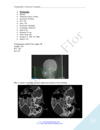 Tomografando a Técnica de Tomografar_______________________________________________________


       Protocolo
       Helical
       Thickness (slice): 0.9mm
       Increment: 0.45mm
       KV: 120
       mAs: 150
       Resolução: Standard
       Colimação: 64x0.625
       Pitch: 0.64
       Rotação: 0.5 sec
       Filtro: Bone (D)
       Window: C: 300 / W: 3000
       Matrix: 512

Tompograma: perfil View angle: 90
Length: 130
KV: 120
mA: 30




Obs: o exame e realizado de duas etapas boca aberta e boca fechada.




                               Email: leonardosflor@gmail.com
                            Blog: http://leonardoflor.blogspot.com/
                                                                                              54
 