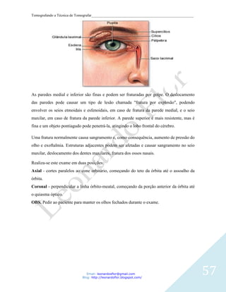 Tomografando a Técnica de Tomografar_______________________________________________________




As paredes medial e inferior são finas e podem ser fraturadas por golpe. O deslocamento
das paredes pode causar um tipo de lesão chamada "fratura por explosão", podendo
envolver os seios etmoidais e esfenoidais, em caso de fratura da parede medial, e o seio
maxilar, em caso de fratura da parede inferior. A parede superior é mais resistente, mas é
fina e um objeto pontiagudo pode penetrá-la, atingindo o lobo frontal do cérebro.

Uma fratura normalmente causa sangramento e, como consequência, aumento de pressão do
olho e exoftalmia. Estruturas adjacentes podem ser afetadas e causar sangramento no seio
maxilar, deslocamento dos dentes maxilares, fratura dos ossos nasais.

Realiza-se este exame em duas posições:
Axial - cortes paralelos ao cone orbitário, começando do teto da órbita até o assoalho da
órbita.
Coronal - perpendicular a linha órbito-meatal, começando da porção anterior da órbita até
o quiasma óptico.
OBS. Pedir ao paciente para manter os olhos fechados durante o exame.




                               Email: leonardosflor@gmail.com
                            Blog: http://leonardoflor.blogspot.com/
                                                                                              57
 