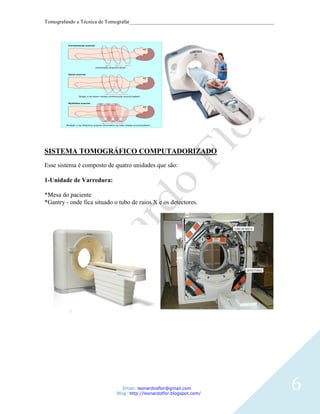 Tomografando a Técnica de Tomografar_______________________________________________________




SISTEMA TOMOGRÁFICO COMPUTADORIZADO
Esse sistema é composto de quatro unidades que são:

1-Unidade de Varredura:

*Mesa do paciente
*Gantry - onde fica situado o tubo de raios X e os detectores.




                                Email: leonardosflor@gmail.com
                             Blog: http://leonardoflor.blogspot.com/
                                                                                              6
 