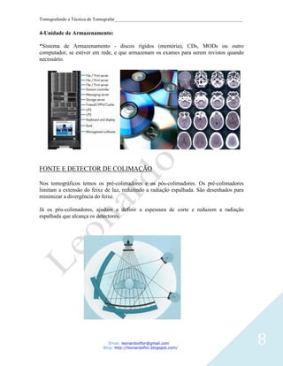 Tomografando a Técnica de Tomografar_______________________________________________________


4-Unidade de Armazenamento:

*Sistema de Armazenamento - discos rígidos (memória), CDs, MODs ou outro
computador, se estiver em rede, e que armazenam os exames para serem revistos quando
necessário.




FONTE E DETECTOR DE COLIMAÇÃO

Nos tomográficos temos os pré-colimadores e os pós-colimadores. Os pré-colimadores
limitam a extensão do feixe de luz, reduzindo a radiação espalhada. São desenhados para
minimizar a divergência do feixe.

Já os pós-colimadores, ajudam a definir a espessura de corte e reduzem a radiação
espalhada que alcança os detectores.




                               Email: leonardosflor@gmail.com
                            Blog: http://leonardoflor.blogspot.com/
                                                                                              8
 