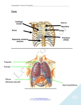 Tomografando a Técnica de Tomografar_______________________________________________________



         Torax



               Cartilage
                                                                                      Esterno:
                Costal
                                                                                       Manúbrio

           Arcos                                                                   Corpo
           Costais


                                                                                        Processo
           Segmento vertebral                                                            xifóide
               torácico




Traquéia

Pulmão




 Pleura                                                  F
 (Recesso pleural)                                        E
                                                         IG                              Seio Costofrênico




                                        Email: leonardosflor@gmail.com
                                     Blog: http://leonardoflor.blogspot.com/
                                                                                                       80
 