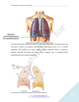 Tomografando a Técnica de Tomografar_______________________________________________________




     Recesso
costodiafragmático
da cavidade pleural

         O sistema respiratório consiste em partes do corpo através das quais o ar passa do nariz e da
         boca para o interior dos pulmões, possibilitando a troca gasosa entre o ar e a corrente
         sangüínea. Está dividido em 4 partes: laringe, traquéia, brônquios direito e esquerdo e
         pulmões. Seguindo da laringe para baixo temos a traquéia, que é a segunda divisão
         propriamente dita do sistema respiratório.




                                         Email: leonardosflor@gmail.com
                                      Blog: http://leonardoflor.blogspot.com/
                                                                                                         81
 