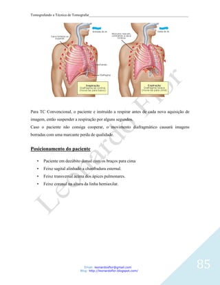 Tomografando a Técnica de Tomografar_______________________________________________________




Para TC Convencional, o paciente e instruído a respirar antes de cada nova aquisição de
imagem, então suspender a respiração por alguns segundos.
Caso o paciente não consiga cooperar, o movimento diafragmático causará imagens
borradas com uma marcante perda de qualidade.


Posicionamento do paciente

   •   Paciente em decúbito dorsal com os braços para cima
   •   Feixe sagital alinhado a chanfradura esternal.
   •   Feixe transversal acima dos ápices pulmonares.
   •   Feixe coronal na altura da linha hemiaxilar.




                               Email: leonardosflor@gmail.com
                            Blog: http://leonardoflor.blogspot.com/
                                                                                              85
 