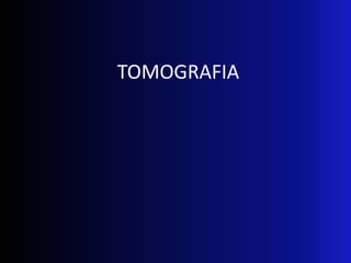 TOMOGRAFIA
 