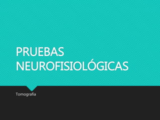 PRUEBAS
NEUROFISIOLÓGICAS
Tomografía
 