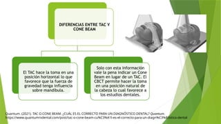 Quantum. (2021). TAC O CONE BEAM. ¿CUÁL ES EL CORRECTO PARA UN DIAGNÓSTICO DENTAL? Quantum.
https://www.quantumrxdental.com/post/tac-o-cone-beam-cu%C3%A1l-es-el-correcto-para-un-diagn%C3%B3stico-dental
DIFERENCIAS ENTRE TAC Y
CONE BEAM
El TAC hace la toma en una
posición horizontal lo que
favorece que la fuerza de
gravedad tenga influencia
sobre mandíbula.
Solo con esta información
vale la pena indicar un Cone
Beam en lugar de un TAC. El
CBCT permite hacer la toma
en una posición natural de
la cabeza lo cual favorece a
los estudios dentales.
 