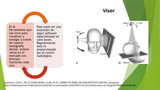 Quantum. (2021). TAC O CONE BEAM. ¿CUÁL ES EL CORRECTO PARA UN DIAGNÓSTICO DENTAL? Quantum.
https://www.quantumrxdental.com/post/tac-o-cone-beam-cu%C3%A1l-es-el-correcto-para-un-diagn%C3%B3stico-dental
Visor
Es la
herramienta que
nos sirve para
visualizar y
navegar a través
de nuestra
tomografía
dental, existen
varios en el
mercado con
diversas
funciones cada
uno.
Este suele ser una
extensión de
algún software
especializado en
cone beam.
Regularmente
este es
proporcionado
por el centro
radiológico.
 