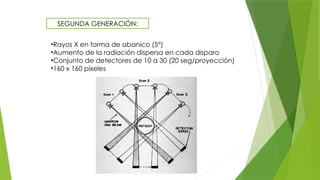 SEGUNDA GENERACIÓN:
•Rayos X en forma de abanico (5°)
•Aumento de la radiación dispersa en cada disparo
•Conjunto de detectores de 10 a 30 (20 seg/proyección)
•160 x 160 píxeles
 