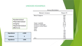 UNIDADES HOUNSFIELD:
•Isodensidad
•Hipodensidad
(negro)
•Hiperdensidad
(Blanco)
 