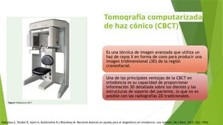 Tomografía computarizada
de haz cónico (CBCT)
Es una técnica de imagen avanzada que utiliza un
haz de rayos X en forma de cono para producir una
imagen tridimensional (3D) de la región
craneofacial.
Una de las principales ventajas de la CBCT en
ortodoncia es su capacidad de proporcionar
información 3D detallada sobre los dientes y las
estructuras de soporte del paciente, lo que no es
posible con las radiografías 2D tradicionales.
Kakadiya A, Tandon R, Azam A, Kulshrestha R y Bhardwaj M. Reciente Avances en ayudas para el diagnóstico en ortodoncia: una revisión. SM J Dent. 2017; 3(2): 1016.
 