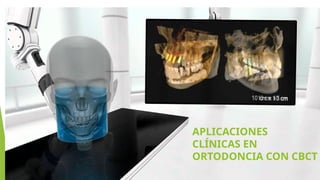 APLICACIONES
CLÍNICAS EN
ORTODONCIA CON CBCT
 