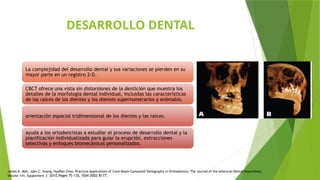 DESARROLLO DENTAL
La complejidad del desarrollo dental y sus variaciones se pierden en su
mayor parte en un registro 2-D.
CBCT ofrece una vista sin distorsiones de la dentición que muestra los
detalles de la morfología dental individual, incluidas las características
de las raíces de los dientes y los dientes supernumerarios y anómalos.
orientación espacial tridimensional de los dientes y las raíces.
ayuda a los ortodoncistas a estudiar el proceso de desarrollo dental y la
planificación individualizada para guiar la erupción, extracciones
selectivas y enfoques biomecánicos personalizados.
James K. Mah, John C. Huang, HyeRan Choo, Practical Applications of Cone-Beam Computed Tomography in Orthodontics, The Journal of the American Dental Association,
Volume 141, Supplement 3. 2010,Pages 7S-13S, ISSN 0002-8177,
 