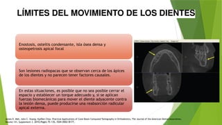 LÍMITES DEL MOVIMIENTO DE LOS DIENTES
Enostosis, osteítis condensante, isla ósea densa y
osteopetrosis apical focal
Son lesiones radiopacas que se observan cerca de los ápices
de los dientes y no parecen tener factores causales.
En estas situaciones, es posible que no sea posible cerrar el
espacio y establecer un torque adecuado y, si se aplican
fuerzas biomecánicas para mover el diente adyacente contra
la lesión densa, puede producirse una reabsorción radicular
apical externa.
James K. Mah, John C. Huang, HyeRan Choo, Practical Applications of Cone-Beam Computed Tomography in Orthodontics, The Journal of the American Dental Association,
Volume 141, Supplement 3. 2010,Pages 7S-13S, ISSN 0002-8177,
 