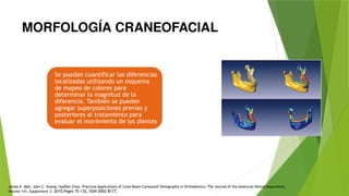 MORFOLOGÍA CRANEOFACIAL
Se pueden cuantificar las diferencias
localizadas utilizando un esquema
de mapeo de colores para
determinar la magnitud de la
diferencia. También se pueden
agregar superposiciones previas y
posteriores al tratamiento para
evaluar el movimiento de los dientes
James K. Mah, John C. Huang, HyeRan Choo, Practical Applications of Cone-Beam Computed Tomography in Orthodontics, The Journal of the American Dental Association,
Volume 141, Supplement 3. 2010,Pages 7S-13S, ISSN 0002-8177,
 