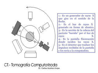 1.- Es un generador de rayos  X que gira en el sentido de la flecha. 2.- Es el haz de rayos X   generado en forma de abanico. 3.- Es la sección de la cabeza del paciente "barrida" por el haz de rayos X. 4.- Es la pantalla fluorescente donde inciden los rayos X. 5.- Es el detector que traduce los impulsos recibidos de la pantalla y los envía a la computadora.                                                     