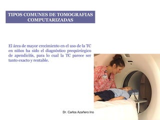 TIPOS COMUNES DE TOMOGRAFIAS COMPUTARIZADAS El área de mayor crecimiento en el uso de la TC en niños ha sido el diagnóstico prequirúrgico de apendicitis, para lo cual la TC parece ser tanto exacto y rentable. 