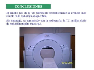 Tomografia Computarizada