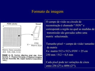 Formato da imagem

       O campo de visão ou circulo de
       reconstrução é chamado “ FOV” e
       corresponde a região na qual as medidas de
        transmissão são gravadas sobre uma
       matriz selecionada.

       Tamanho pixel = campo de visão/ tamanho
       da matriz
       Ex: matriz 512 x 512 e FOV = 25 cm
       250 mm / 512 = 0,5 mm

       Cada pixel pode ter variações de cinza
       entre 256 (28) a 4096 (212).
                   8           12
 