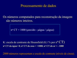 Processamento de dados


Os números computados para reconstrução da imagem
  são números inteiros.

       no CT = 1000 (µtecido - µágua / µágua)



K: escala de contraste de Hounsfield (0,1 % por no CT)
no CT da água= 0; no CT do osso = +1000; no CT do ar = - 1000
 o                 o                      o




2000 números representam a escala de contraste (níveis de cinza).
 